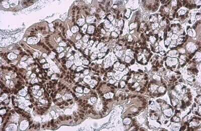 Immunohistochemistry-Paraffin: c-jun [p Ser73] Antibody [NBP3-13304]